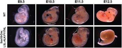 Expression of the Neuroblastoma-Associated ALK-F1174L Activating Mutation During Embryogenesis Impairs the Differentiation of Neural Crest Progenitors in Sympathetic Ganglia